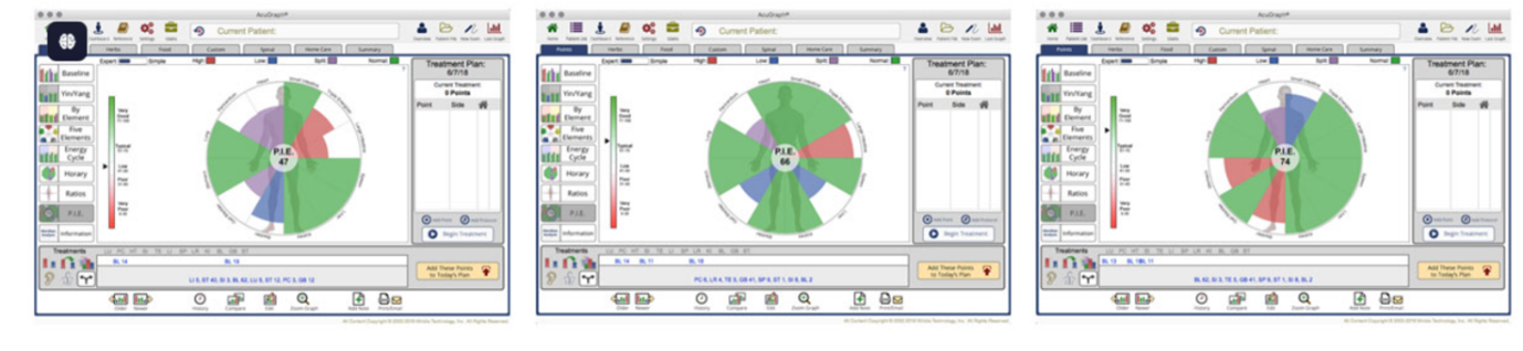 MERİDYEN TERAPİ / ACUGRAPH